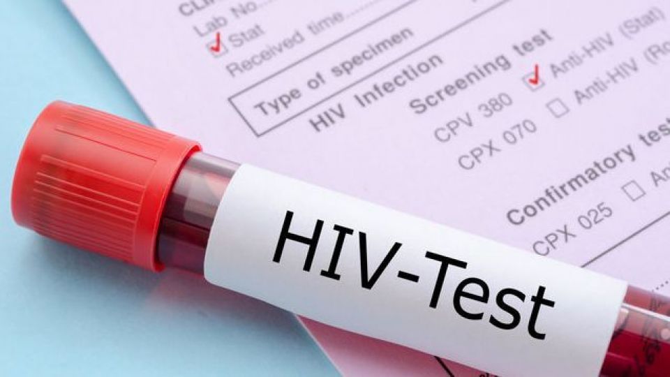 علائم Hiv در زنان