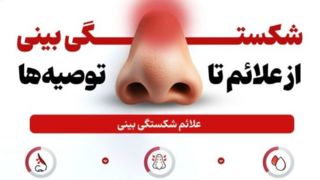 هرآنچه درباره شکستگی بینی لازم است بدانید