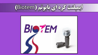 مقایسه و بررسی کامل ایمپلنت های دندانی: بایوتم، آیرس و اشترومن مقایسه و بررسی کامل ایمپلنت های دندانی: بایوتم، آیرس و اشترومن