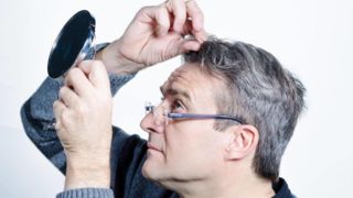 ارتباط بین سفید شدن موها و ابتلا به سرطان ارتباط بین سفید شدن موها و ابتلا به سرطان