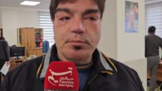 اولین تصویر از مردی که عمل بلفارو کرده بود | بی خیال عربلو نمیشوم | ۹ بار به اتاق بیهوشی رفتم اولین تصویر از مردی که عمل بلفارو کرده بود | بی خیال عربلو نمیشوم | ۹ بار به اتاق بیهوشی رفتم