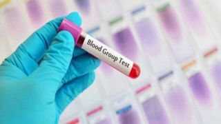 کدام گروه خونی بیشتر از همه سکته مغزی میکند؟ کدام گروه خونی بیشتر از همه سکته مغزی میکند؟